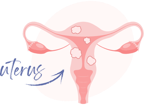Diagram of a uterus